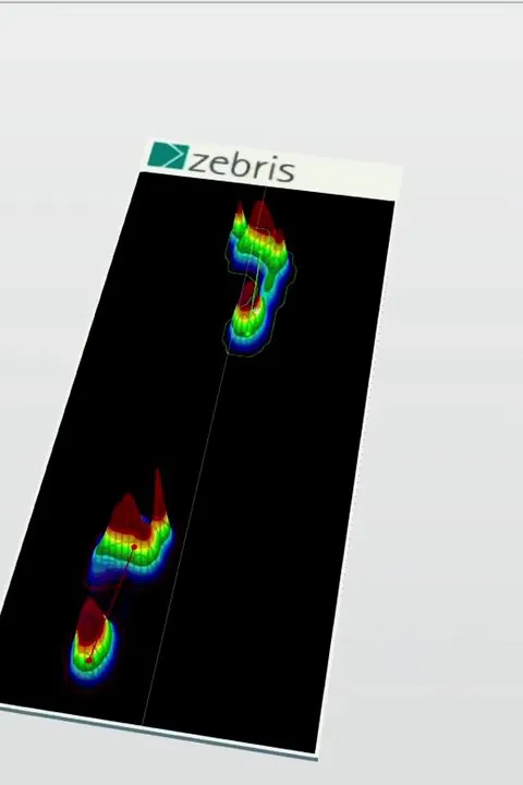 A Zebris pressure map showing the pressure under each footstep on the treadmill.