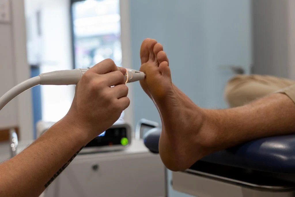 swift therapy wart removal